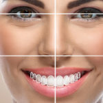 روش‌های اصلاح طرح لبخند