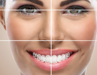 روش‌های اصلاح طرح لبخند