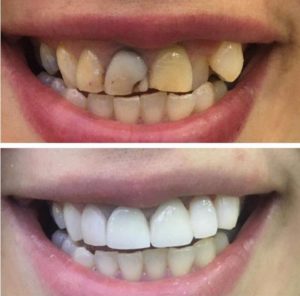 متخصص  ترمیم و زیبایی دندان تهران