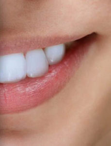 متخصص ترمیم و زیبایی دندان