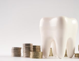 بلیچینگ دندان ارزان قیمت-1
