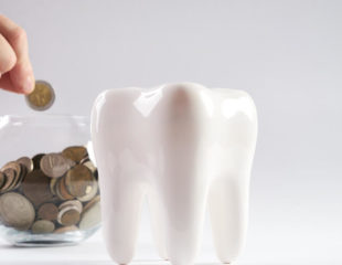 هزینه بلیچینگ دندان-1