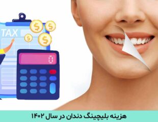 هزینه بلیچینگ دندان در سال 1402