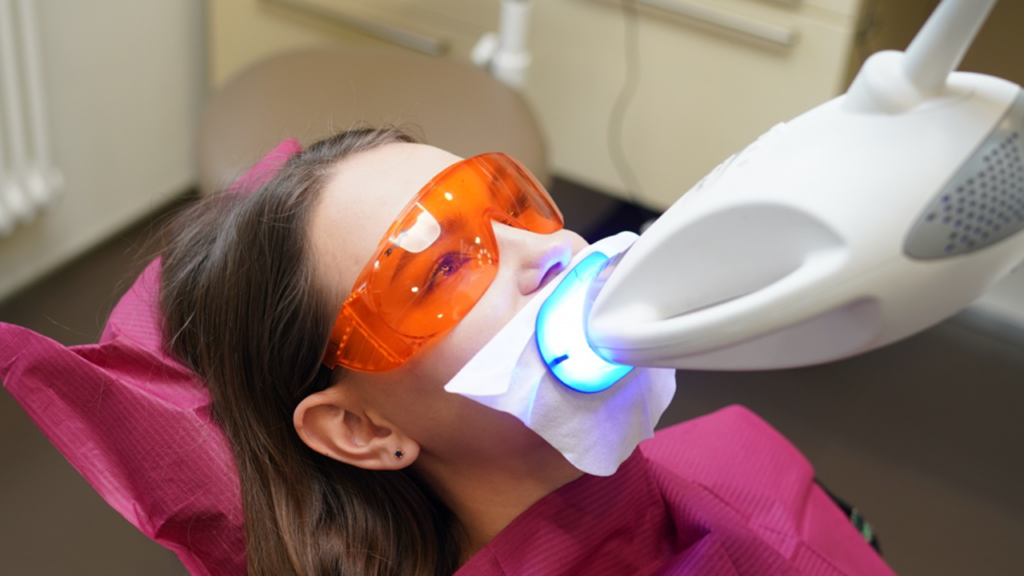 بلیچینگ دندانپزشکی