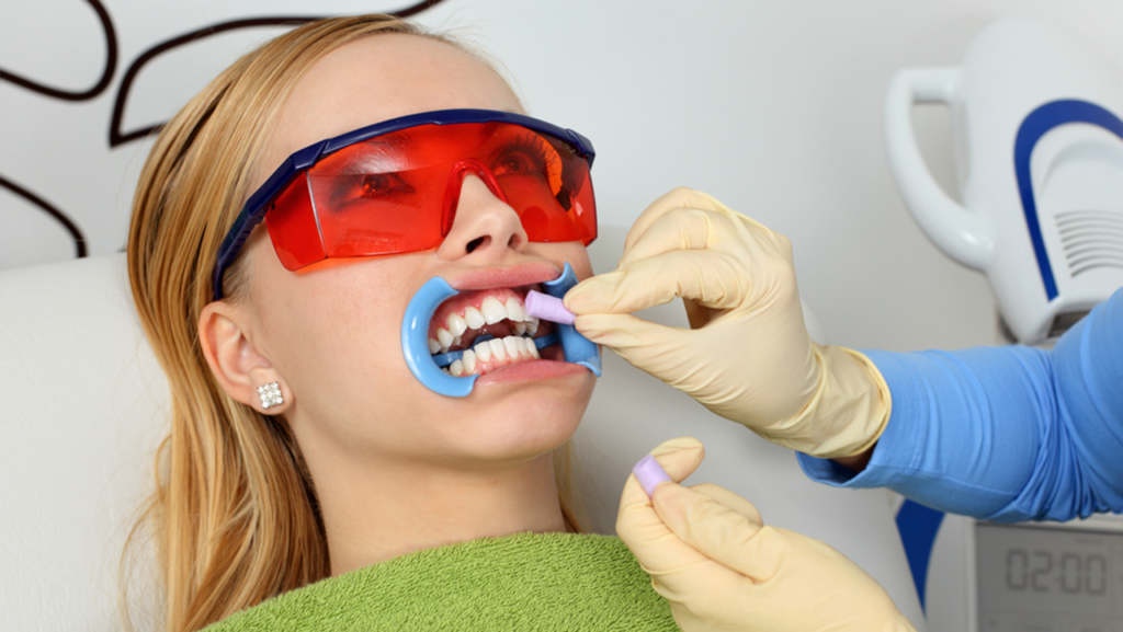 بلیچینگ دندانپزشکی
