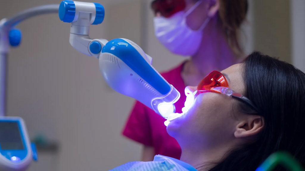 روش‌های بلیچینگ دندان