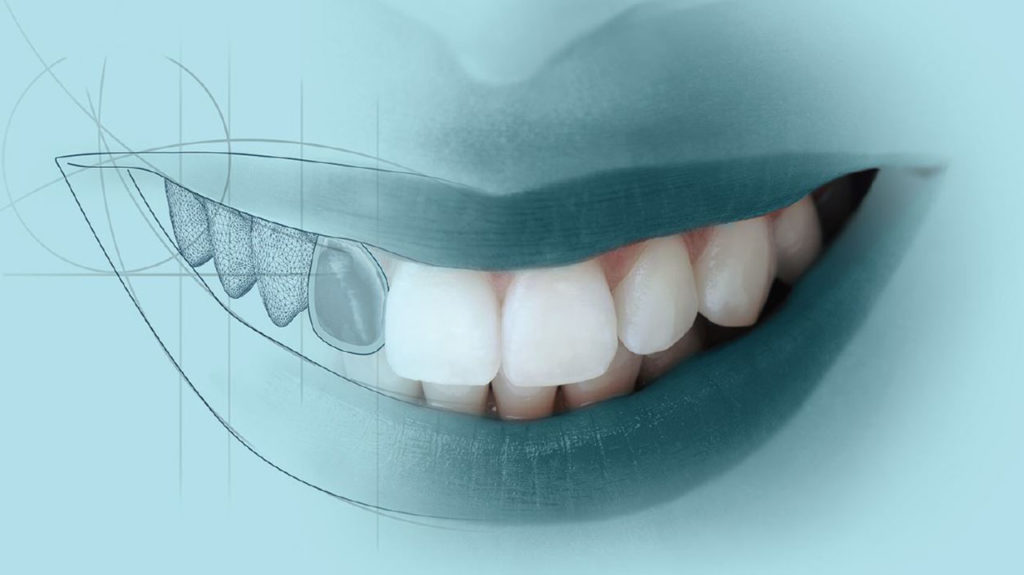 تغییر و اصلاح فرم دندان
