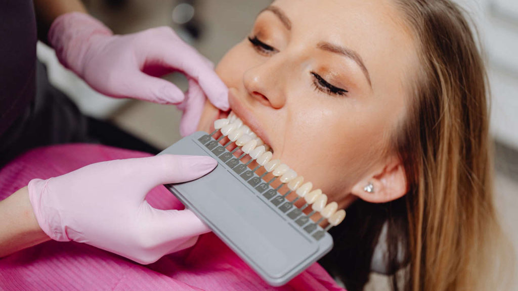 عوارض لمینت دندان چیست