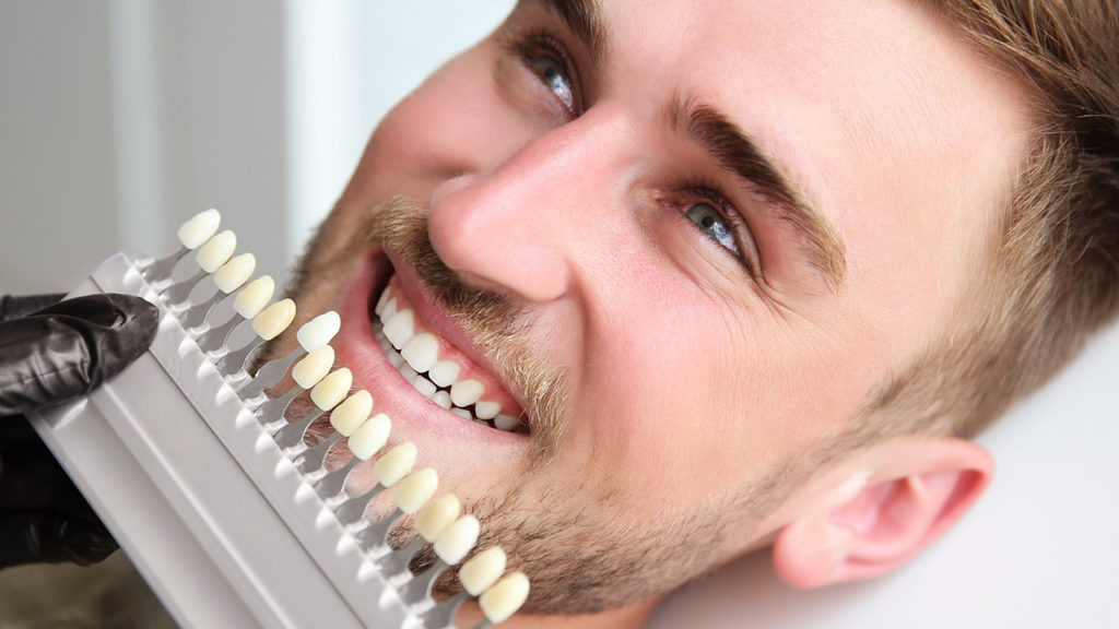 راه‌های پیشگیری از عوارض لمینت دندان