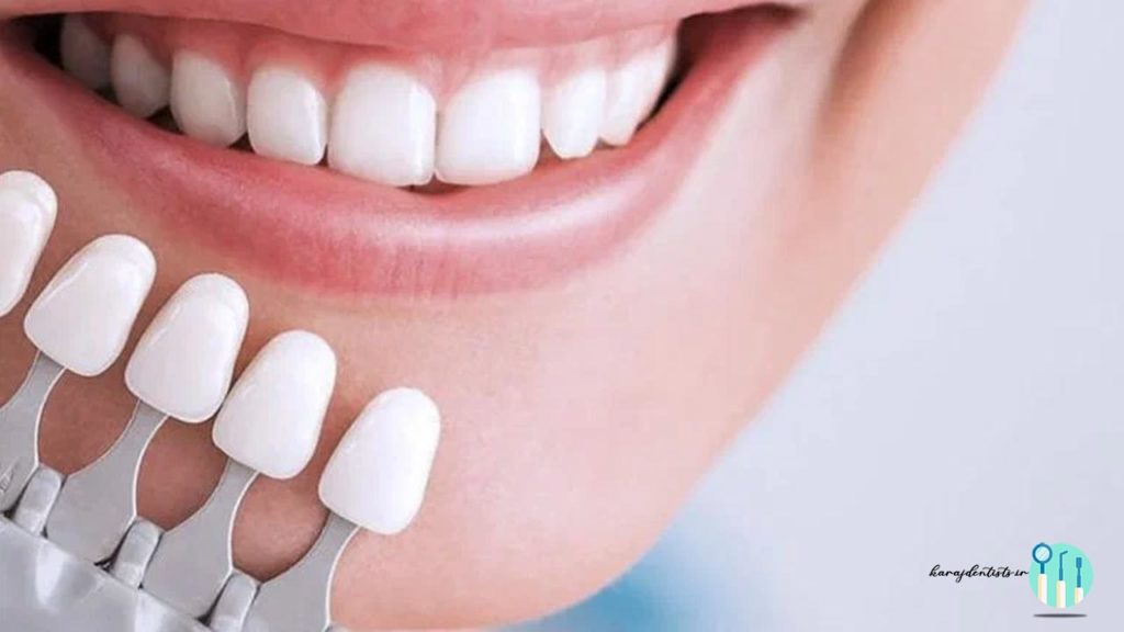 آیا رنگ لمینت تغییر می کند؟