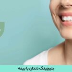 بلیچینگ دندان با بیمه