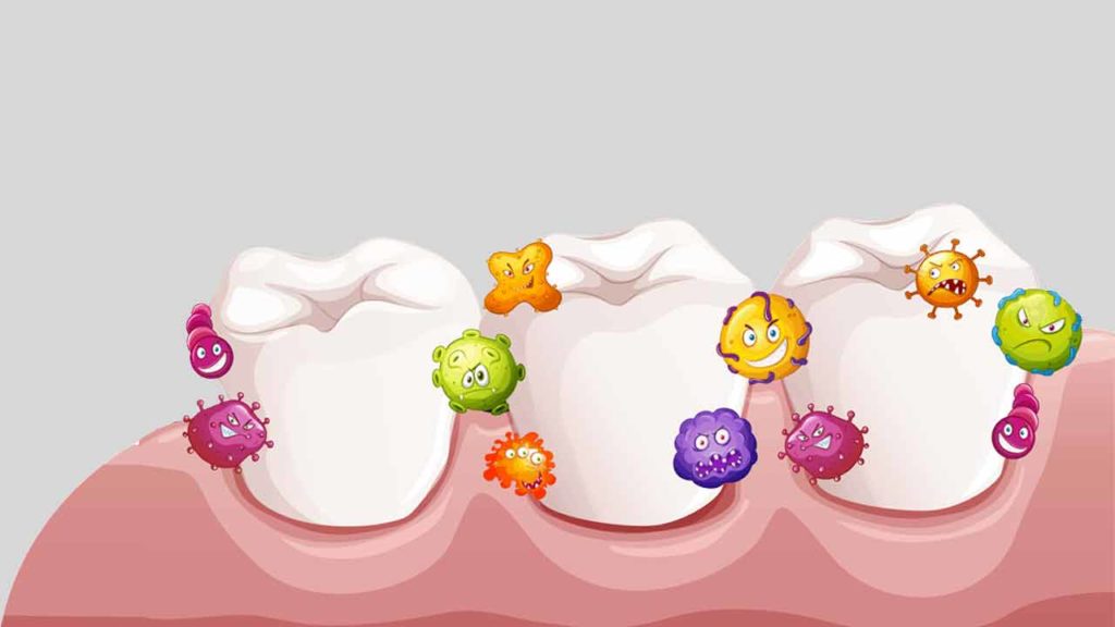 انواع ترمیم دندان پوسیده