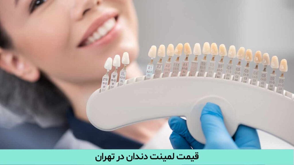 قیمت لمینت دندان در تهران