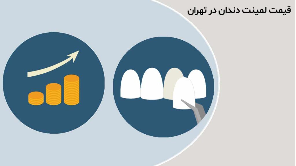 قیمت لمینت دندان در تهران