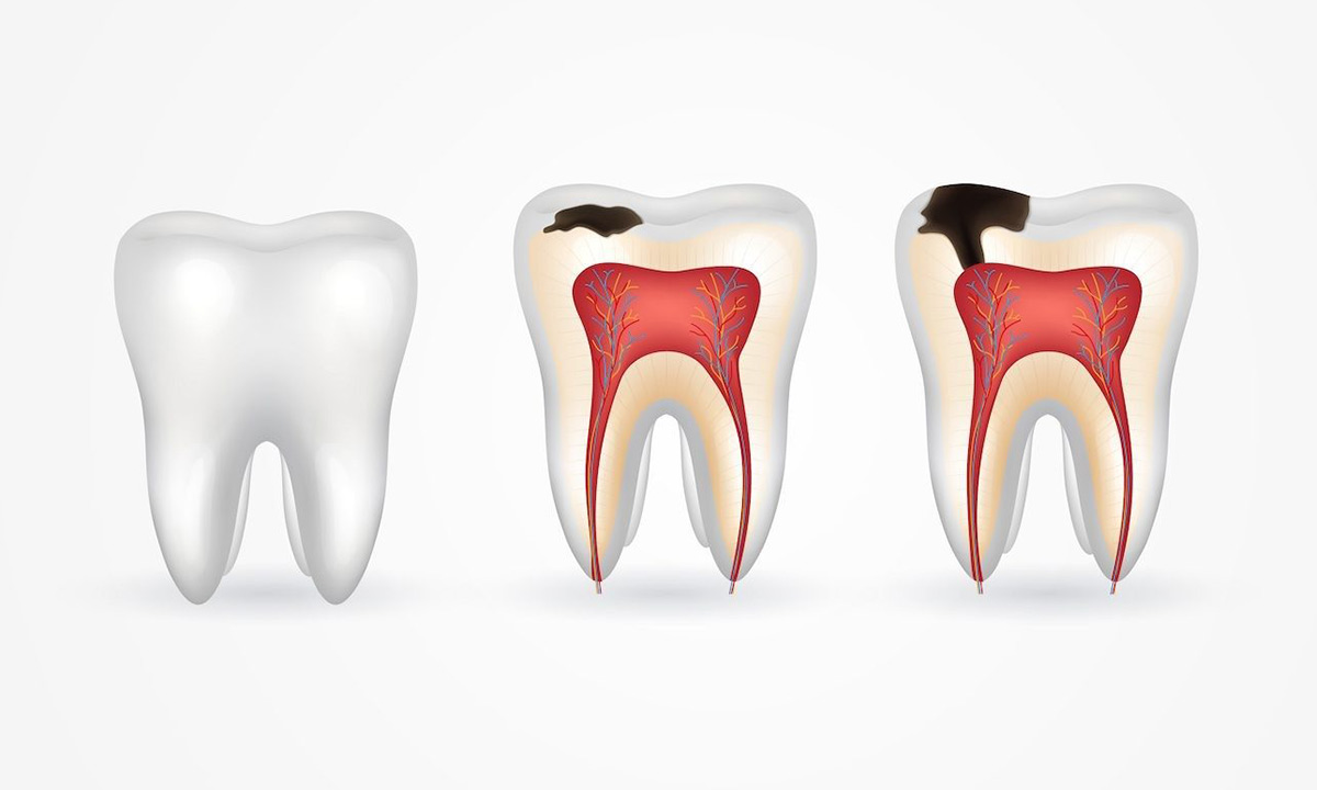 پیشگیری از مشکلات دندانی