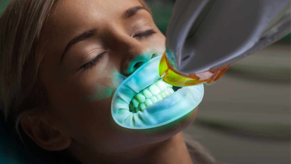بلیچینگ دندانپزشکی چیست؟
