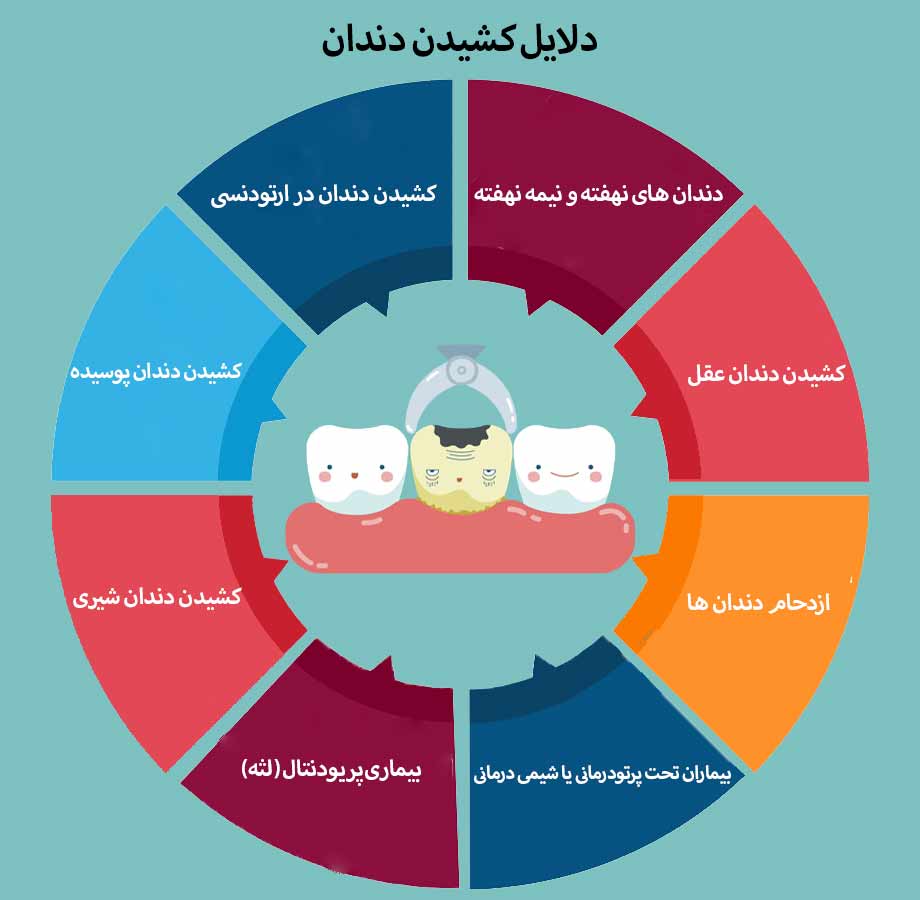 دلایل کشیدن دندان