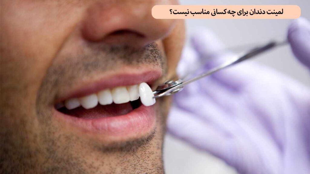 لمینت دندان برای چه کسانی مناسب نیست؟
